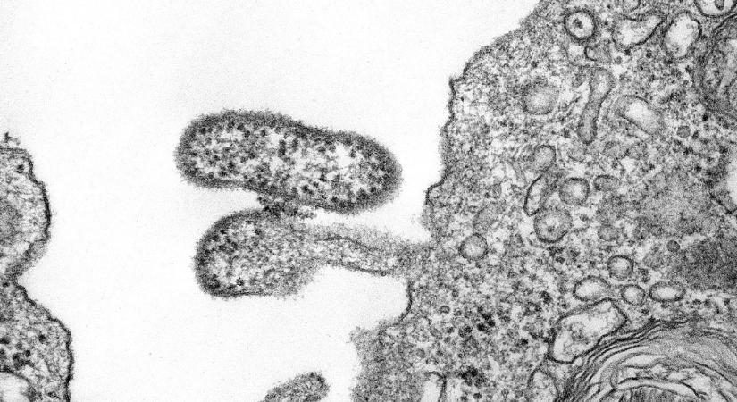 Rendkívül ritka, ebolához hasonlító vírus okozta vérzéses lázban halt meg egy bolíviai férfi