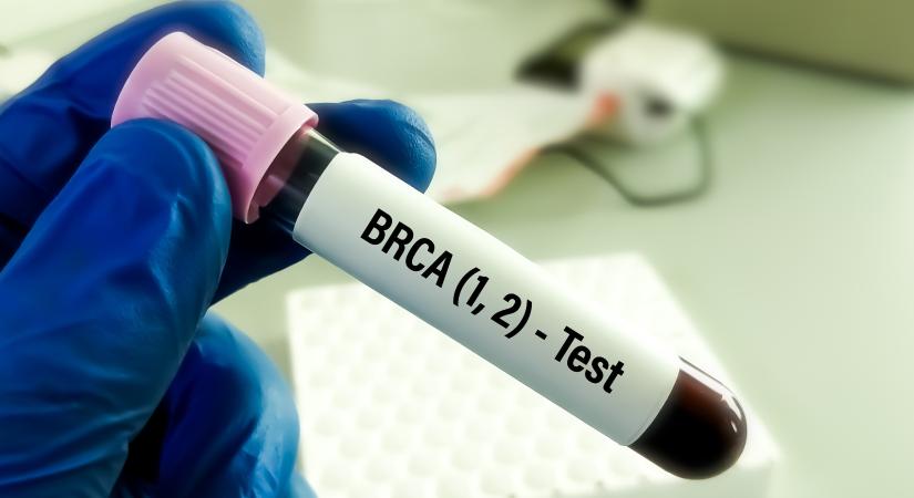 BRCA-vizsgálat: mennyibe kerül, hogyan kérhető?