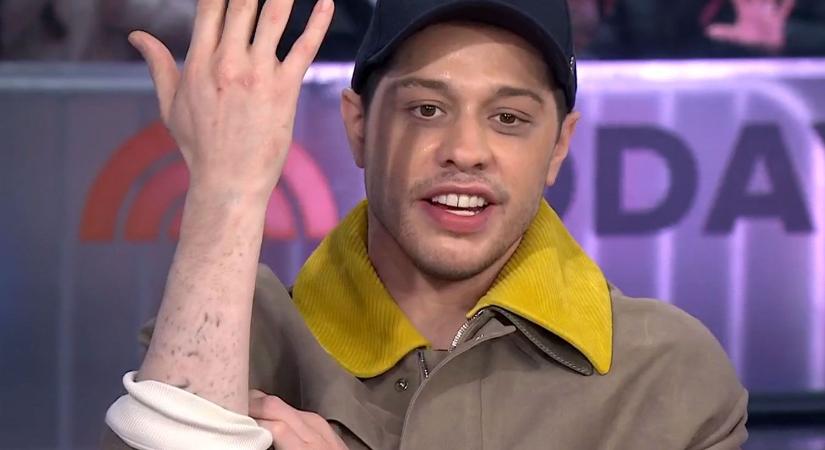 Pete Davidson drasztikus lépésre szánta el magát: megszabadult az eddigi védjegyétől