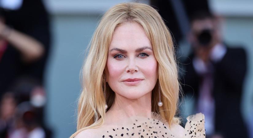 Nicole Kidman még a rajongóit is sokkolta az új külsejével