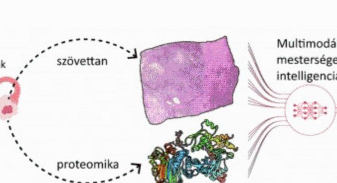 Mesterséges intelligenciával a személyre szabottabb petefészekrák-kezelésért