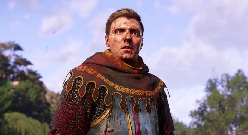 Ezekkel a Kingdom Come: Deliverance 2 modokkal megkönnyítheted Henry életét