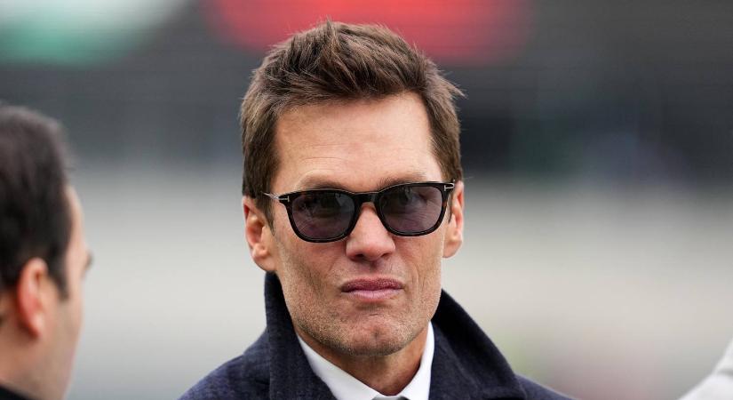 Tom Brady arcplasztikájáról vitatkoznak az orvosok