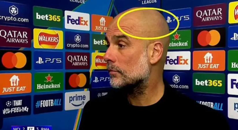 Újabb összeomlás, újabb karcolások Guardiola fején