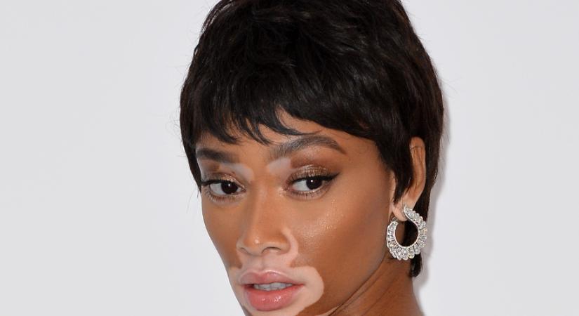 Winnie Harlow szupermodell gyönyörű konyháját másolja mindenki – fehér, de másképp