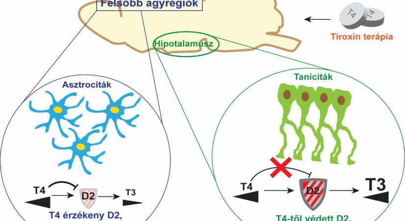 Az „agyköd” eloszlatása – magyar kutatók felfedezése nagy lépést jelenthet a pajzsmirigy alulműködés gyógyításában