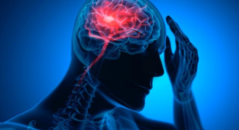 Ez a meglepő tünet hónapokkal előre jelezheti a stroke-ot: ne hagyd figyelmen kívül, ha ezt tapasztalod