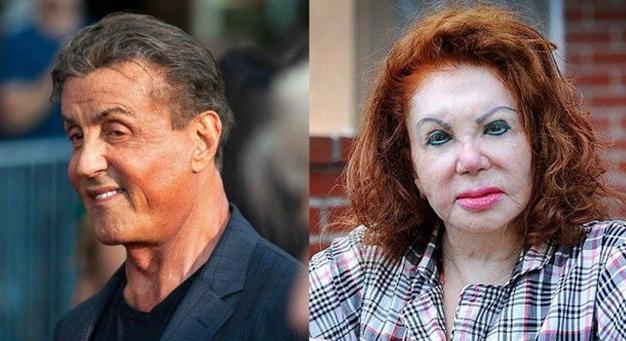 Sylvester Stallone és anyja, Jackie Stallone arcát így tette tönkre a plasztika