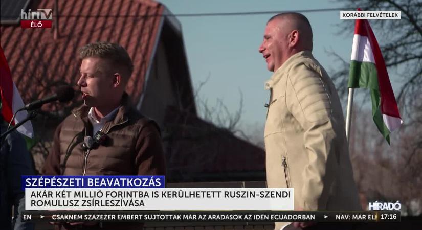 Akár két millió forintba is kerülhetett Ruszin-Szendi Romulusz TB-zsírleszívása  videó