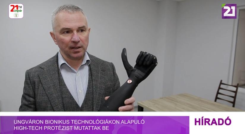 Ungváron bionikus technológiákon alapuló high-tech protézist mutattak be (videó)