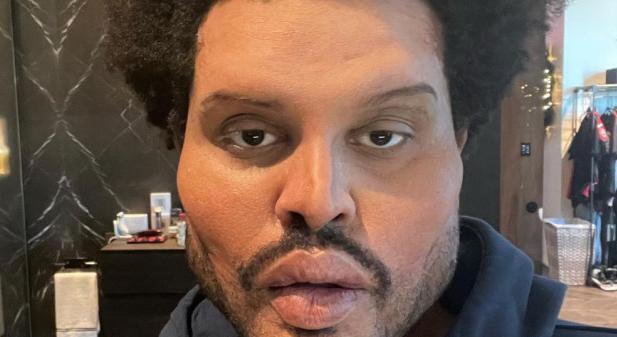 Ismét ijesztő kinézettel forgatott klipet The Weeknd