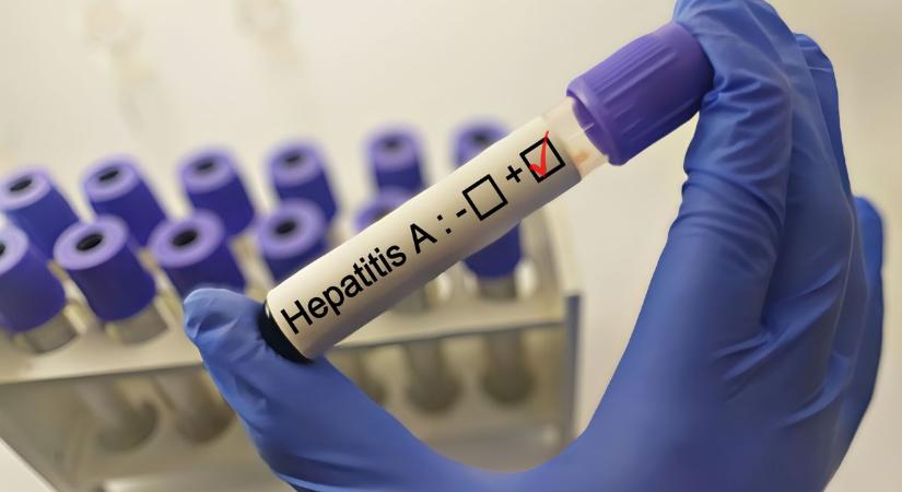 Hepatitisjárvány miatt figyelmeztetnek, gyorsan terjed