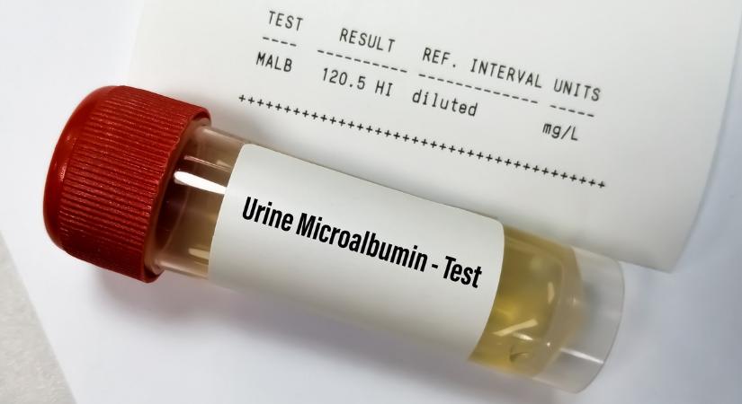 Mit jelent a vizelet mikroalbumin érték a laborleleten?
