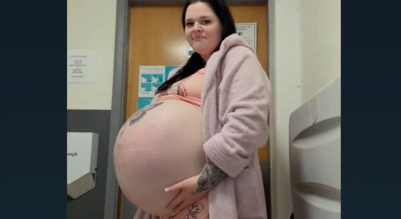 Ritka betegség miatt lett óriási a kismama pocakja: így néz ki a babája - Videók