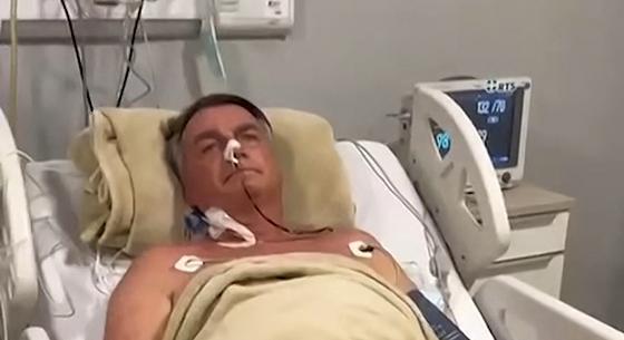 Romlott Bolsonaro állapota, intenzív osztályon kezelik