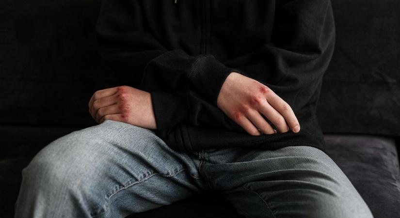 Durva balhé az egyik szombathelyi panzióban: kegyetlenül megtaposta a másik arcát és mellkasát egy vasi férfi
