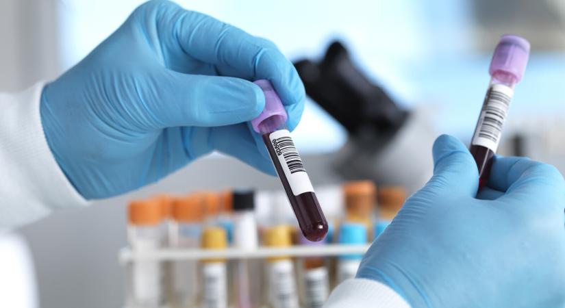 Új, forradalmi rákdiagnosztikai módszer jöhet hamarosan