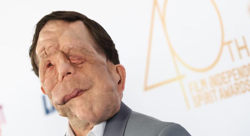Adam Pearson játszhatja el az elefántembert