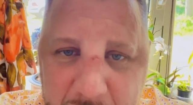 Úgy berúgott Zámbó Krisztián, hogy eltört az orra