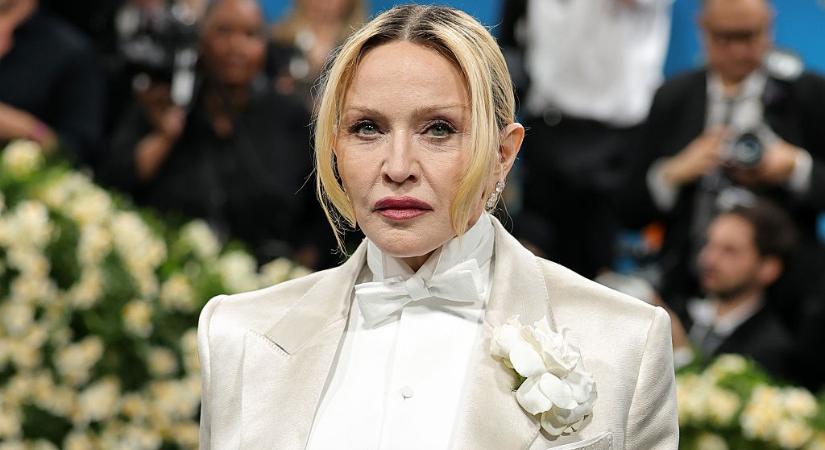 Mi történt Madonna mosolyával? A rajongók szerint az egyik legjellegzetesebb vonását változtatta meg