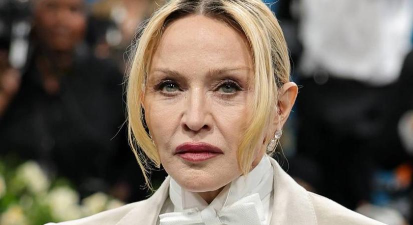 Így nézne ki Madonna plasztikai műtétek nélkül: döbbenetes a különbség