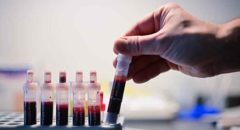 Az orvos figyelmeztetett: ezekre az értékekre figyelj a vérvételednél