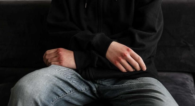Szexuális erőszak gyanúja egy sepsiszentgyörgyi szállodában zajlott szakmai gyakorlaton