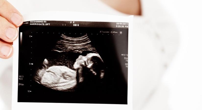 Ismét rekordévet zárt a Planned Parenthood: minden eddiginél több volt az abortusz Amerikában