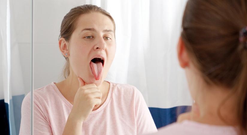 A nyelvünk színe erről árulkodhat: a lila és kék szín is komoly betegségre utal