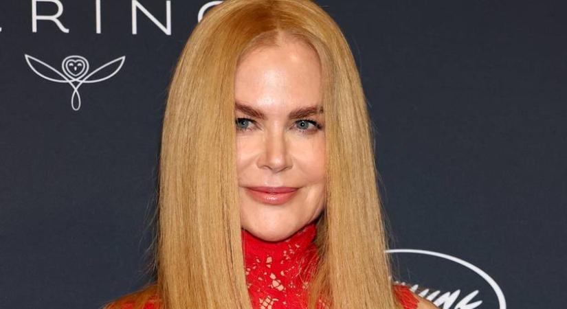 Nicole Kidman lebukott: ciki dolog történt a parókájával