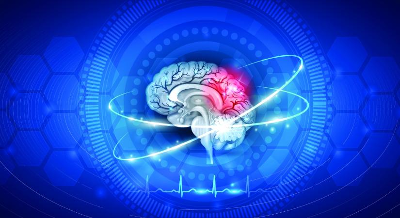 Gyémánt szintű elismerését kapott az SE stroke-ellátó programja
