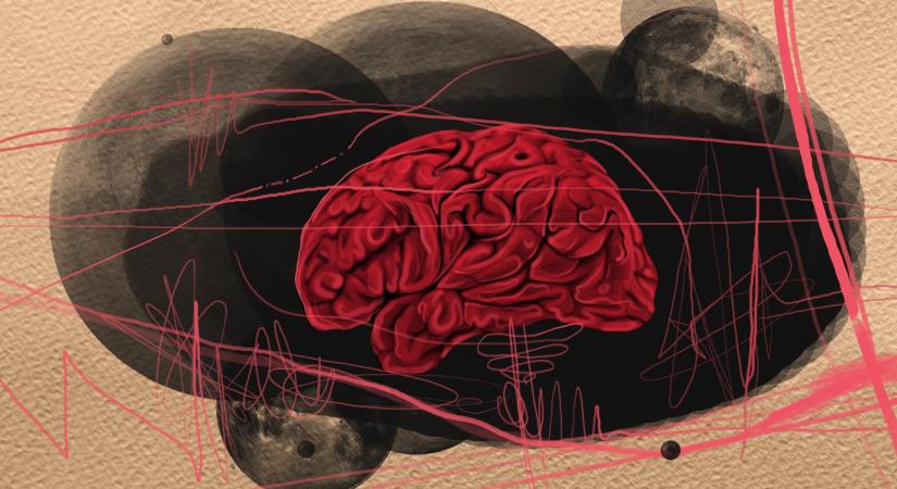 3 dolog, ami növeli a rokkantságot okozó stroke esélyét