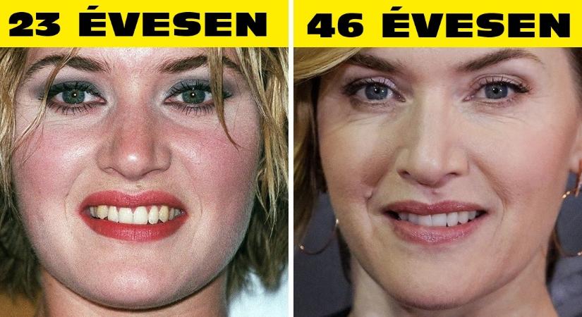 15 híresség, akik nem törődnek az idővel és csak még szebbek lettek az évek során