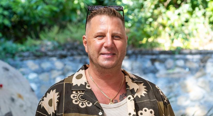 Drasztikus lépésre szánta el magát Zámbó Krisztián: átszabatja az arcát
