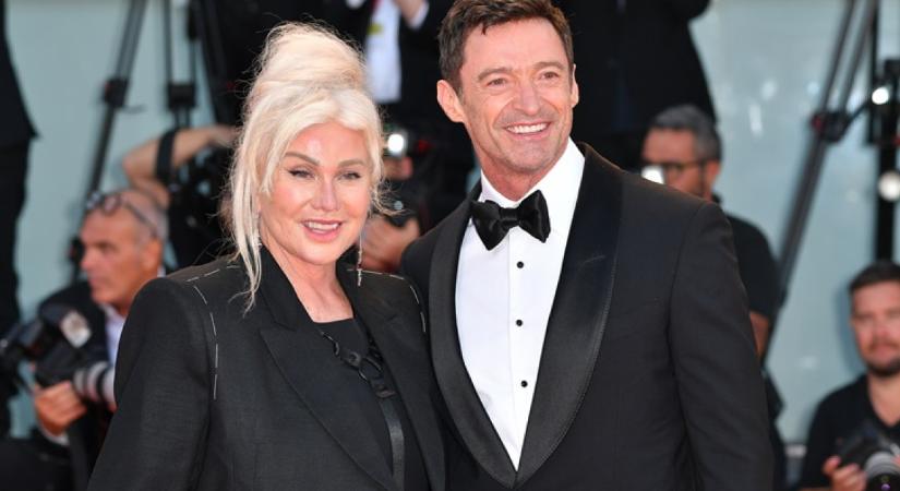 Megelégelte a hallgatást Hugh Jackman volt felesége: felkavaró, mit mondott a hűtlen világsztárról