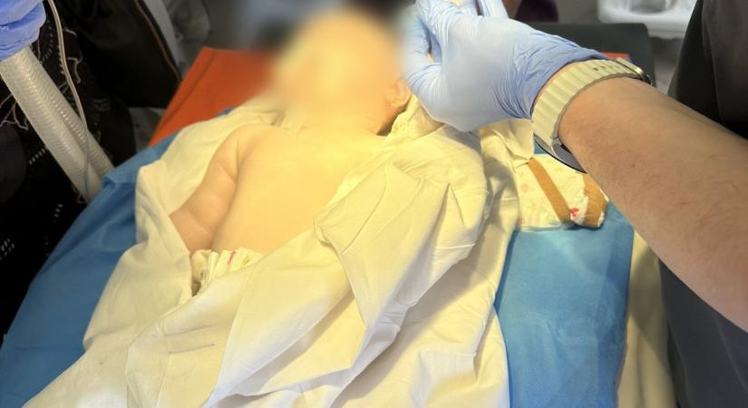 A kárpátaljai megyei kórházban egy 6 hónapos kislány gyomrából hajcsatot távolítottak el