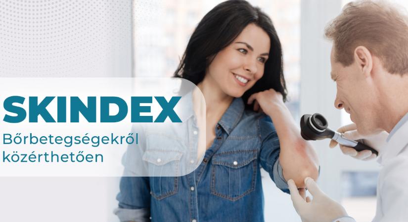 Jön a nyár, a bőrgyógyászok a neten segítenek: bemutatjuk a Skindex weboldalt
