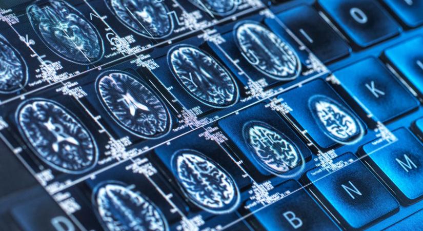 MI az orvostudományban: OpenAI-alapú program forradalmasítaná az egészségügyi adminisztrációt