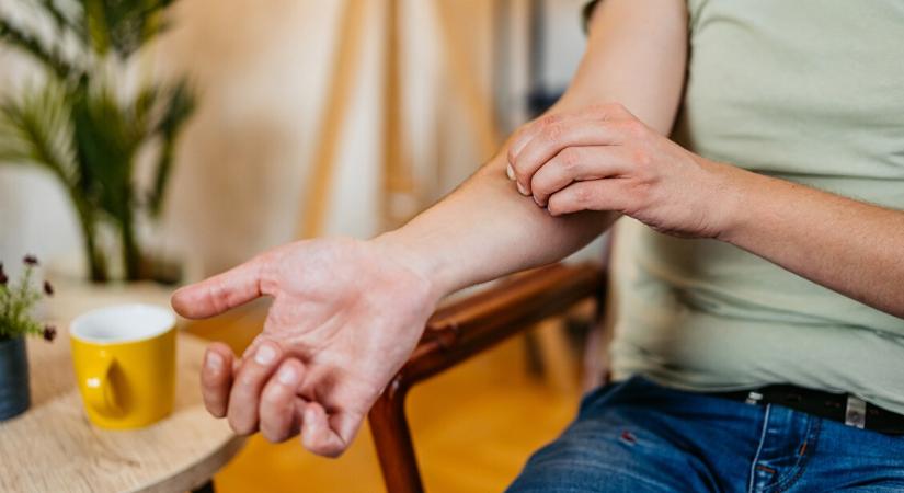Jön a szúnyoginvázió – így tartsd távol a vérszívókat