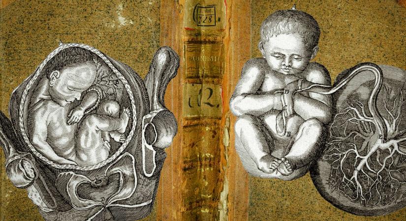 Hogyan szültek a nők, amikor még nem terelték kórházba őket?