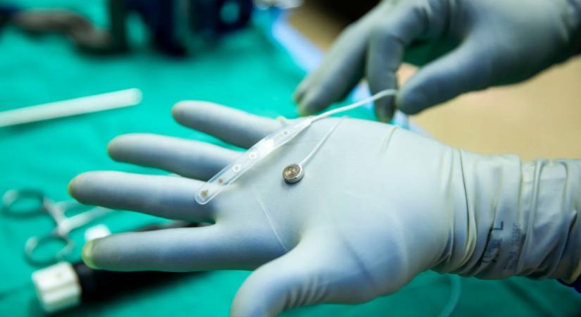 A Paradromics új agyi implantátumot tesztelt emberben