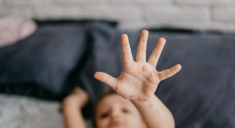 Rég elfeledett halálos gyerekbetegségek - itt az orvos válasza, miért tűnhetnek fel