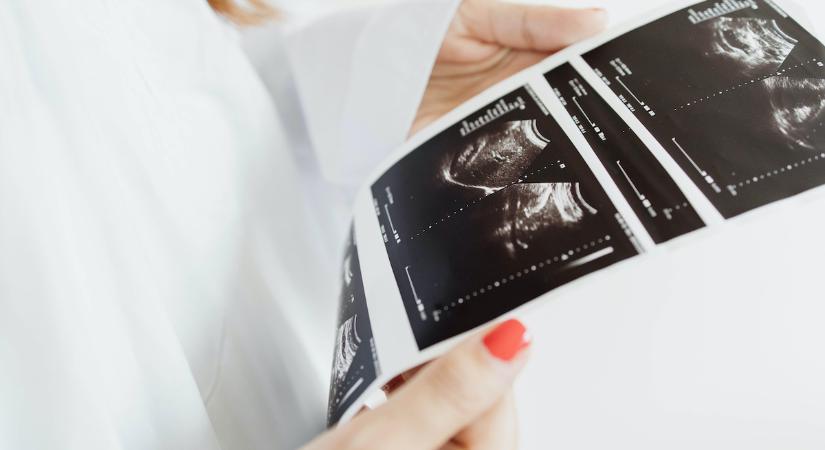 Embrionális fejlődés: ennyi minden történik ebben az időszakban