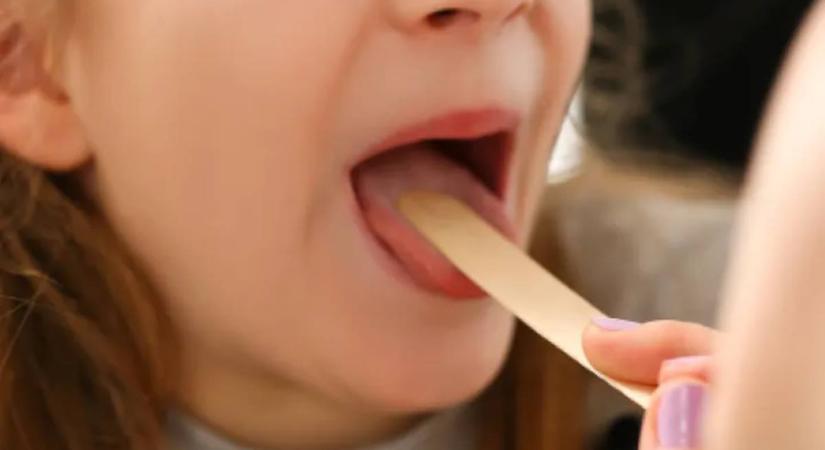 Torokgyulladás a melegben? A légkondi is okozhatja