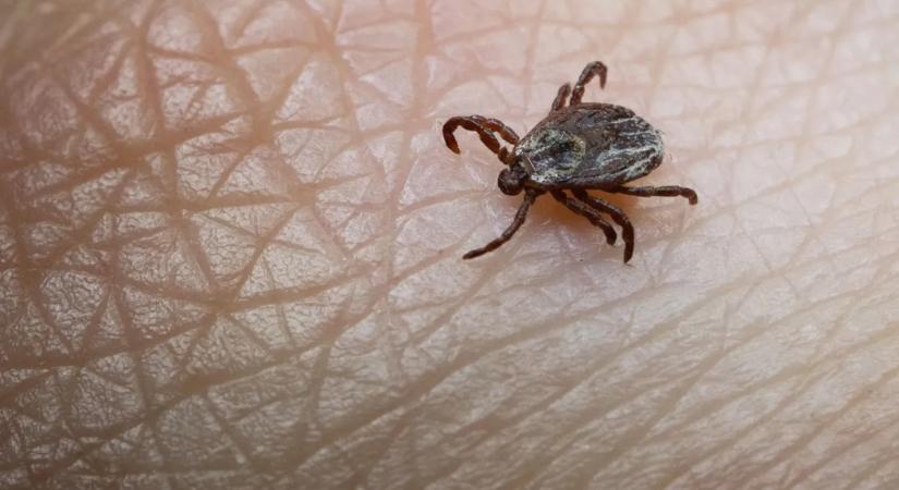 Ezt mindenképpen tegye meg, ha kullancs fúródik a bőrébe