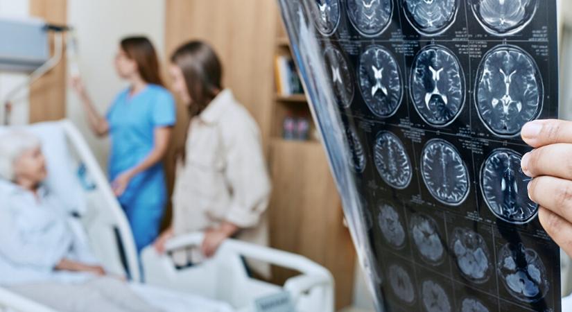 Létezik tünetmentes Alzheimer-kór is: a páciens még nem érzékeli, de az agya már nem a régi