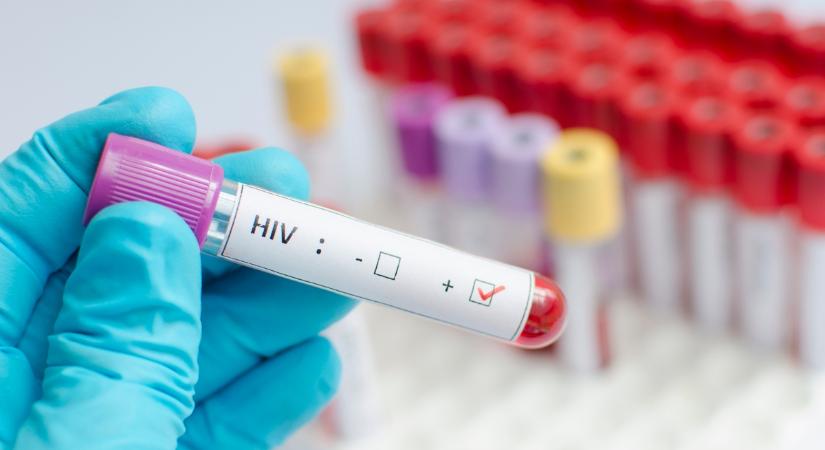 Áttörést értek el a HIV-fertőzés gyógyításában