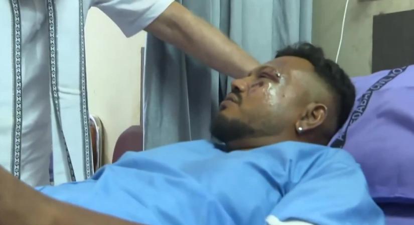 „Azt hittem, meg fogok halni” – újabb drámai részleteket árult el az indiai repülőgép-katasztrófa egyetlen túlélője