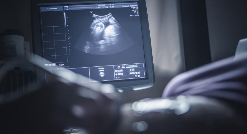 Kötelező terhességi vizsgálatok – Ezeken kell részt venni