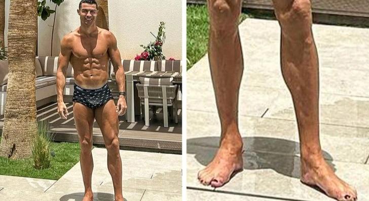 Cristiano Ronaldo feketére festett lábkörme az „internet új sztárja” - Sport365